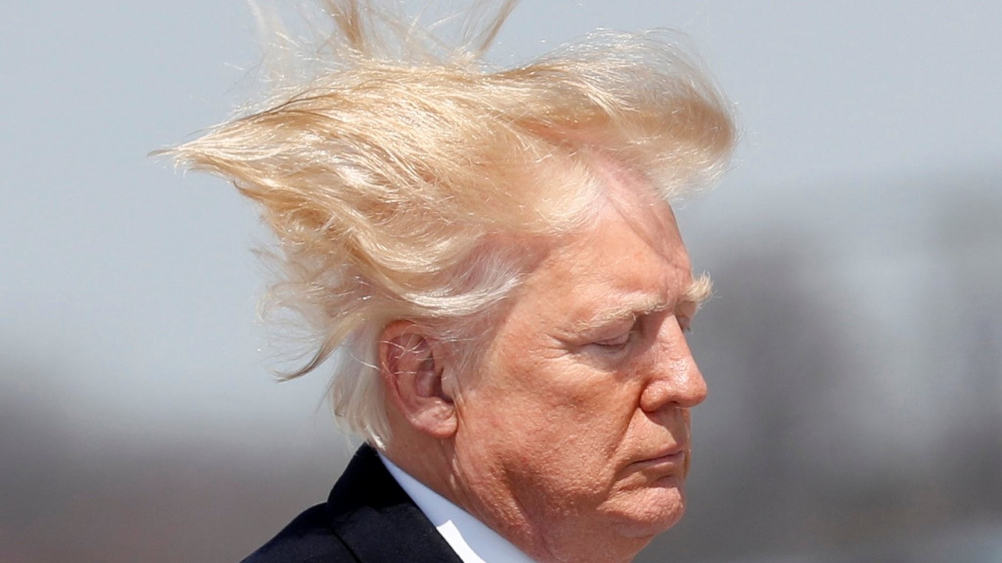 Donald Trump Hair Transplant: The Facts You Need to Know